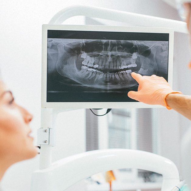 5477-dentist_showing_patient_xrays-1200x628-FACEBOOK 5477-dentist_showing_patient_xrays-1200x628-FACEBOOK